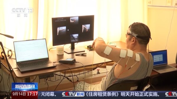 广发E配 什么样的患者适合手术？如何进行康复训练？探访我国首个脑机接口病房